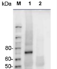 ZEP | Zeaxanthin Epoxidase (anti-peptide) in the group Antibodies for Plant/Algal / Photosynthesis / Carotenoid metabolism at Agrisera AB (Antibodies for research) (AS08 289)